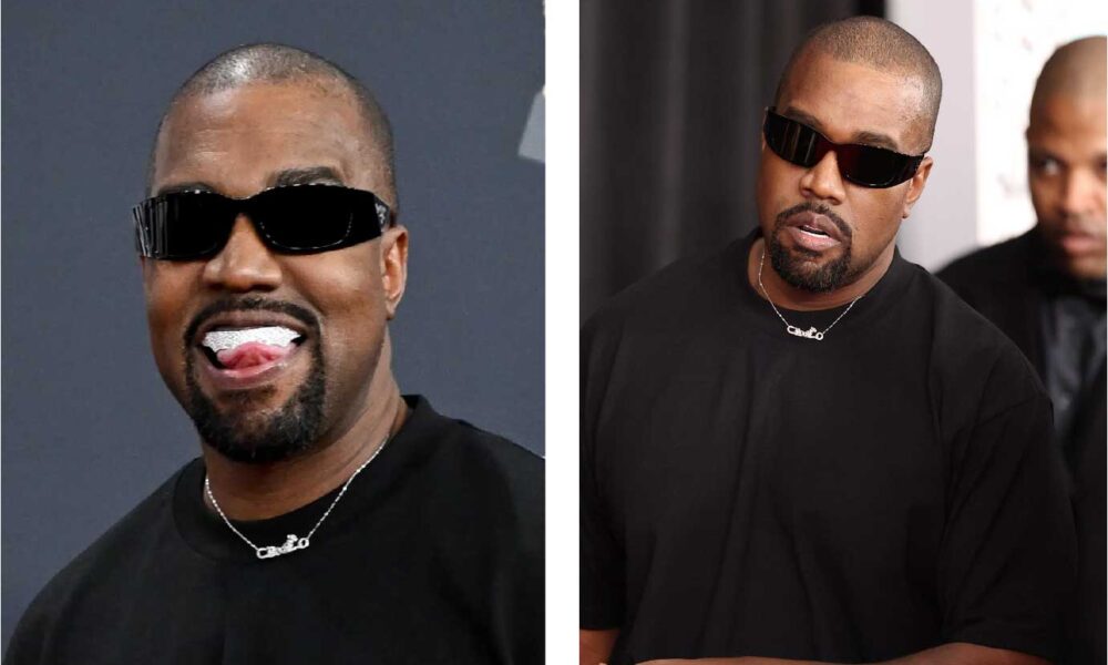 Kanye West Teeth
